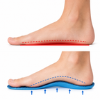 Semelles Orthopédiques Spéciales Hallux Valgus