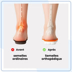 Semelles Orthopédiques Confort 4D Anti-Douleur — vue 4