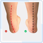 Semelles Orthopédiques Soulagement Pieds — vue 4