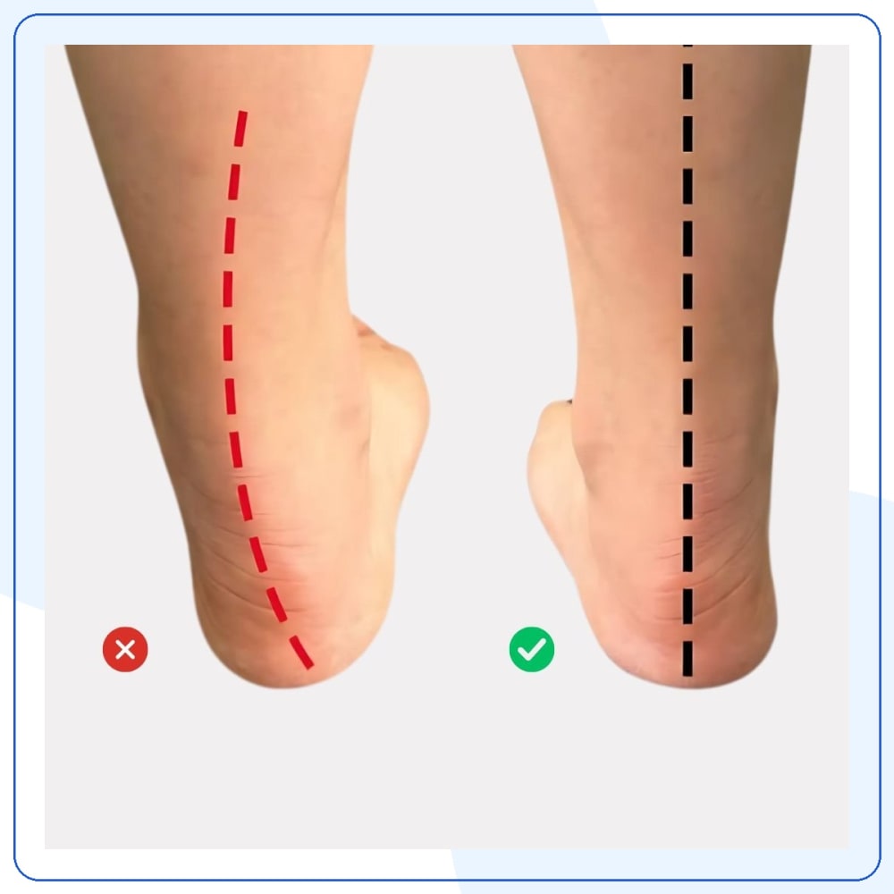 Semelles Orthopédiques Soulagement Pieds — vue 4