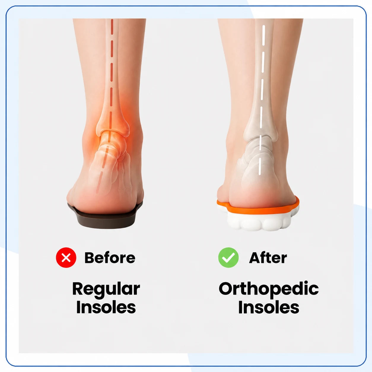 Semelles Orthopédiques Confort 4D Anti-Douleur — vue 4